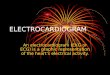ELECTROCARDIOGRAM An electrocardiogram (EKG or ECG) is a graphic representation of the heart’s electrical activity