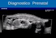 Diagnostico Prenatal. Diagnóstico Prenatal  Hoy en día se puede detectar desde etapas muy tempranas del embarazo malformaciones y anomalías de muy diversa