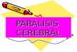 PARÁLISIS CEREBRAL. INTRODUCCIÓN Definición La parálisis cerebral es una alteración que afecta al músculo, la postura y el movimiento, provocada por