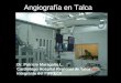 Angiografía en Talca Dr. Patricio Maragaño L. Cardiólogo Hospital Regional de Talca Integrante del PIFRECV