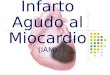 Infarto Agudo al Miocardio (IAM). Definición  Cuadro clínico que acompaña a la necrosis miocárdica, de origen isquémico.  Es urgencia médica