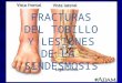 FRACTURAS DEL TOBILLO Y LESIONES DE LA SINDESMOSIS