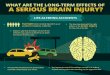 Long Term Effects of a Serious Brain Injury