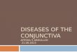 Diseases of the conjunctiva   Ayesha s Abdullah  21.09.2013