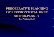 PREOPERATIVE PLANNING OF REVISION TOTAL KNEE ARTHROPLASTY  J.J. Prosser, D.O