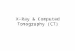 X-Ray & Computed Tomography (CT)