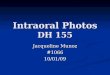 Intraoral Photos DH 155
