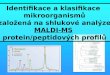 Identifikace a klasifikace  mikroorganismů založená na shlukové analýze MALDI-MS
