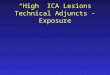 “High” ICA Lesions Technical Adjuncts - Exposure