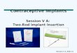 Contraceptive Implants Session V A:  Two-Rod Implant Insertion
