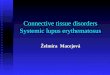 Connective tissue disorders Systemic lupus erythematosus