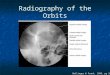 Radiography of the Orbits