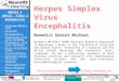 Herpes Simplex Virus Encephalitis Benedict Daniel  Michael