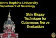 Skin Biopsy Technique for  Cutaneous  Nerve Evaluation