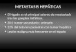 METASTASIS HEPTICAS