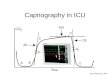 Capnography in ICU