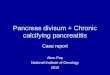 Pancreas divisum + Chronic calcifying pancreatitis