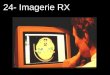 24- Imagerie RX