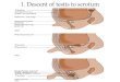 1.  Descent of testis to scrotum