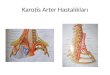 Karotis  Arter Hastalıkları