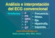 Análisis e interpretación  del ECG  convencional
