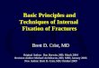 Basic Principles and Techniques of Internal  Fixation of Fractures