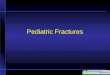 Pediatric Fractures
