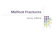 Midfoot Fractures