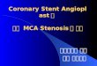 Coronary Stent Angioplast 를  통한  MCA Stenosis 의 치료