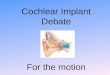 Cochlear Implant Debate For the motion