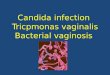 Candida infection  T ricpmonas vaginalis Bacterial  vaginosis