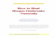 Treating Herpes Naturally