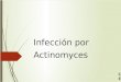 Infección Por Actinomyces