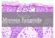 Micosis fungoide y Nefritis lúpica