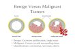 Benign: Excessive proliferation; single mass Malignant: Cancer; invade surrounding tissue Classifications: carcinomas, sarcomas, others Benign Versus Malignant