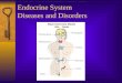 Endocrine System Diseases and Disorders. Gigantism  hyper GH before 25  extreme skeletal size