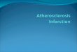 Atherosclerosis Atherosclerosis is a specific form of arteriosclerosis (thickening & hardening of arterial walls) affecting primarily the intima of large