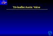 Tri-leaflet Aortic Valve. Aortic Stenosis Nishimura, RA et al. 2014 AHA/ACC Valvular Heart Disease Guideline