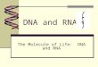 DNA and RNA The Molecule of Life: DNA and RNA. DNA vs. RNA Summary DNARNA By comparison they both have: Sugar phosphate background Nitrogenous bases By