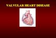 VALVULAR HEART DISEASE. Goals and Objectives Discuss the common etiologies of valvular stenosis and regurgitation. Recognize the signs and symptoms of