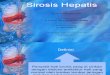 Sirosis Hepatis Isip Alvina