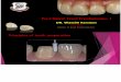 L1 - Principles of Tooth Preparation