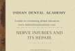 Nerve Injuries / orthodontic courses by Indian dental academy