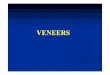 Veneers (6)