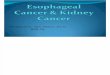 Esophageal Cancer & Kidney Cancer