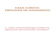 Caso Clinico - Tiroiditis de Hashimoto