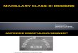 Maxillary Class-III Designs