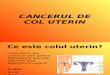 22889096 Cancerul de Col Uterin