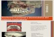 Anatomia Funcional y Biomecnica Del Sistema Masticatorio Vpdf