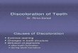 lecture 4 (part 2) Discoloration of Teeth (Slide)